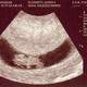 Ultrasound was still a promising new technology when the queen had her last child.